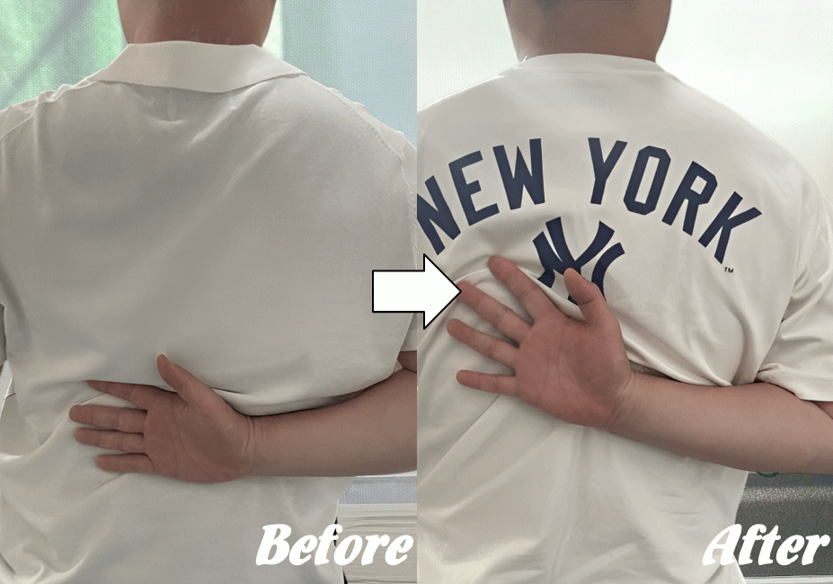 施術前と施術後07