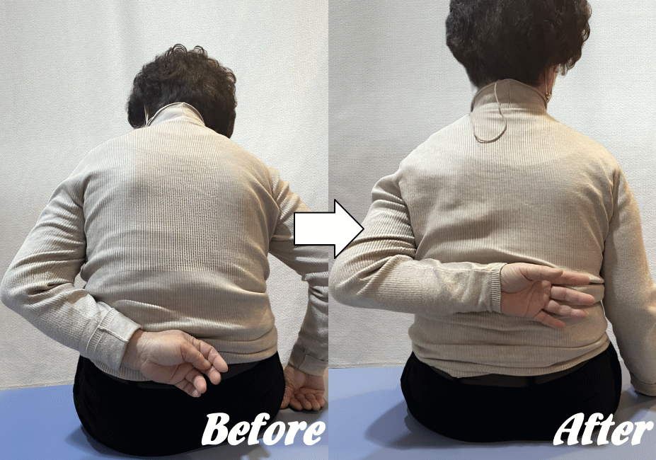 施術前と施術後08