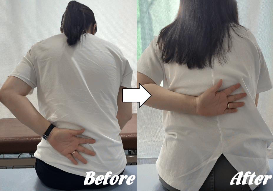 施術前と施術後09