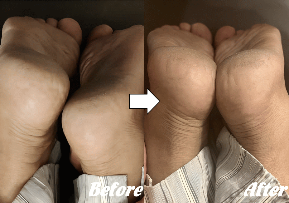 施術前と施術後11