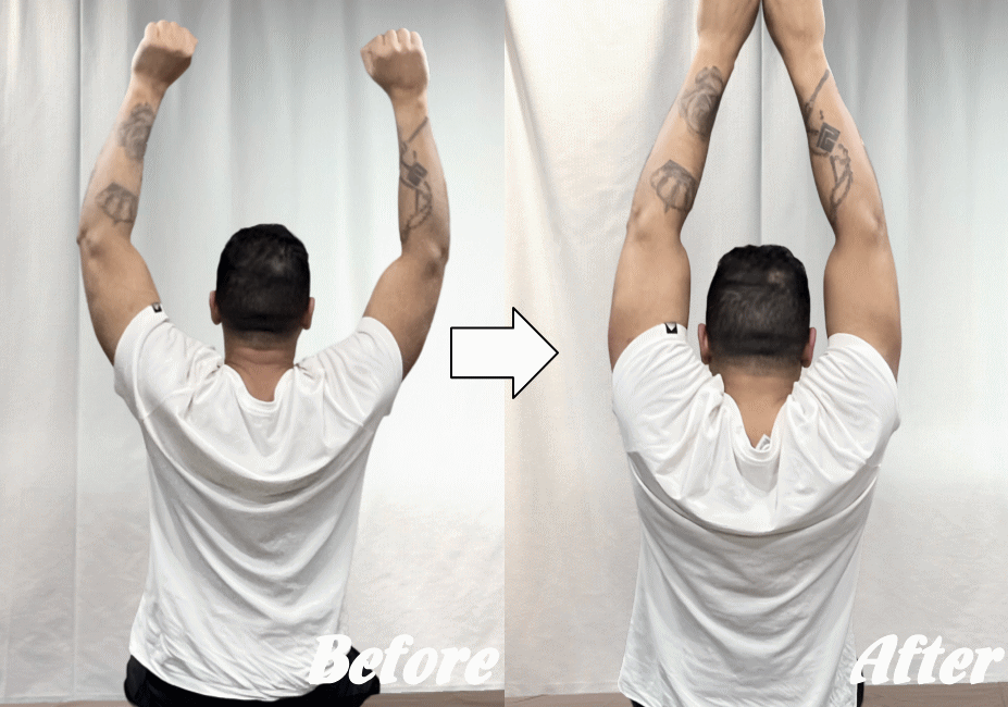 施術前と施術後12