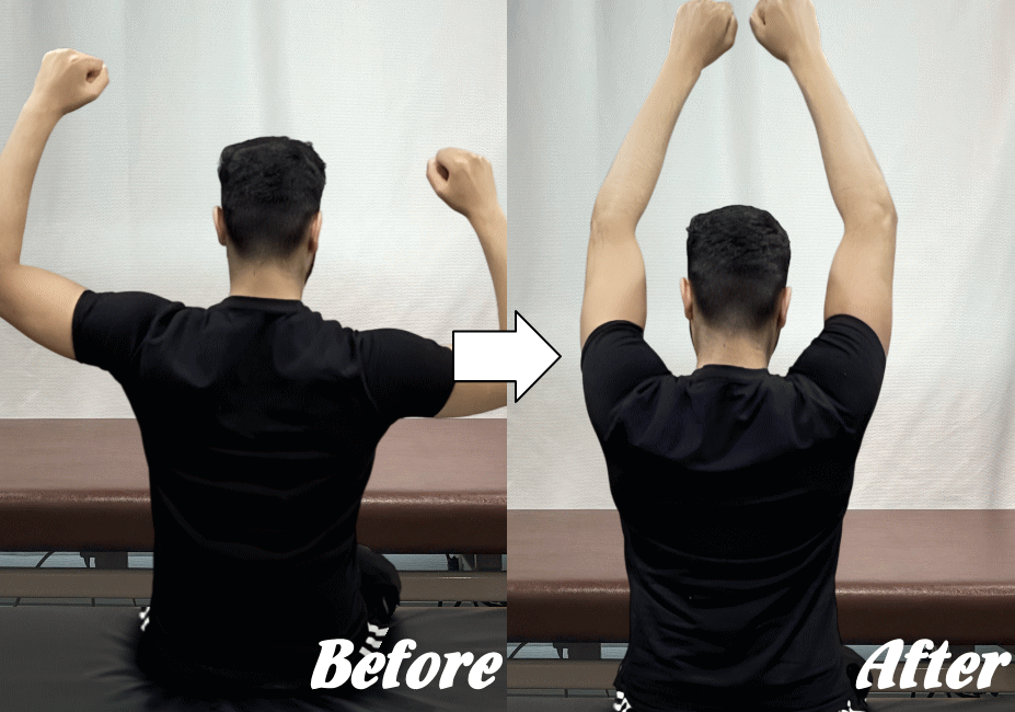 施術前と施術後13