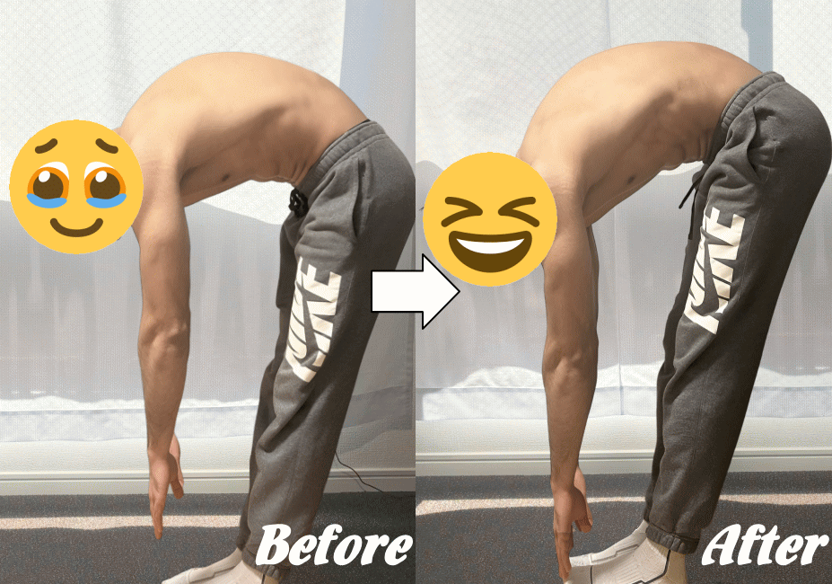 施術前と施術後14