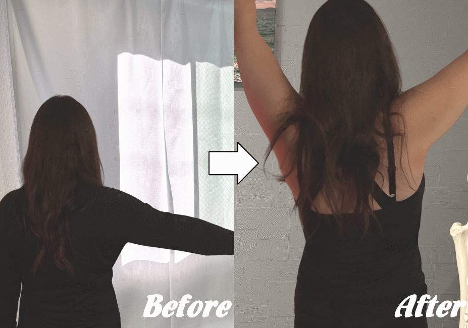 施術前と施術後16