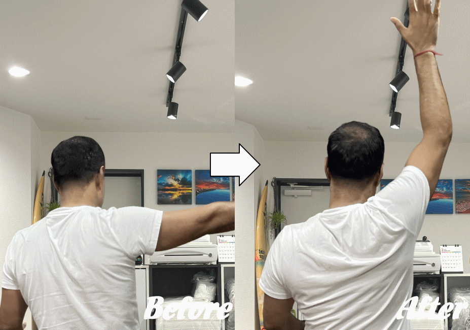 施術前と施術後17