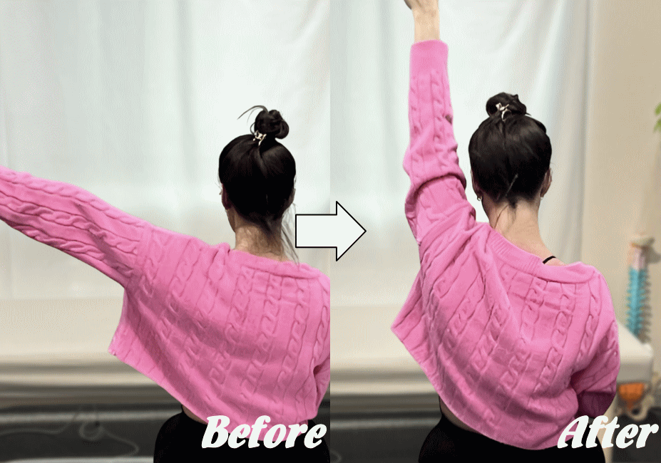 施術前と施術後18