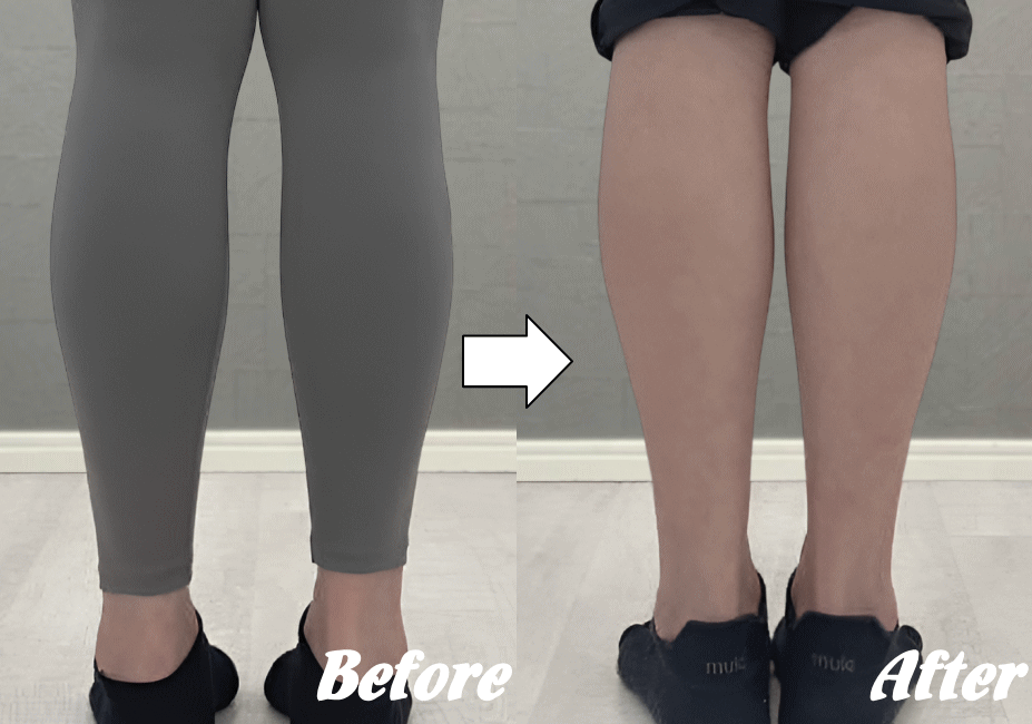 施術前と施術後19