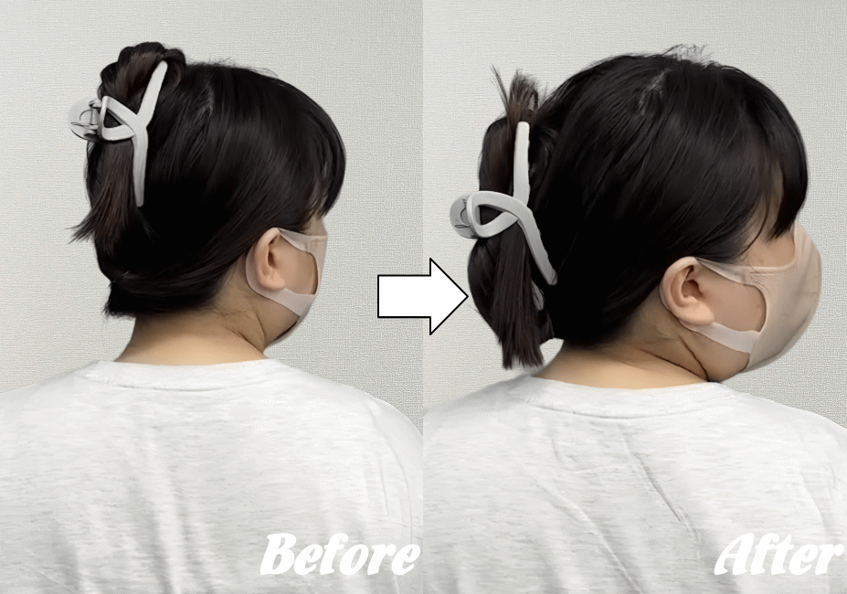 施術前と施術後20