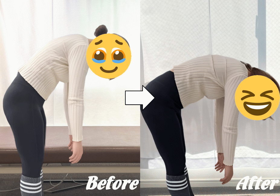 施術前と施術後21