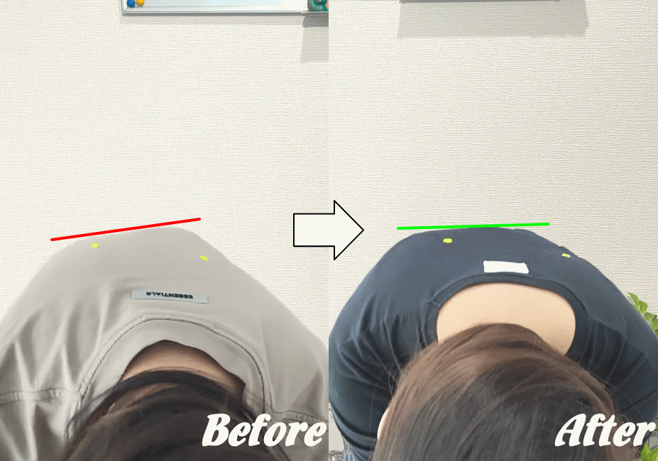 施術前と施術後22