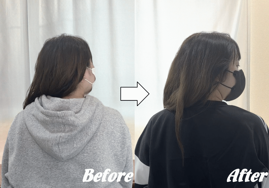 施術前と施術後23