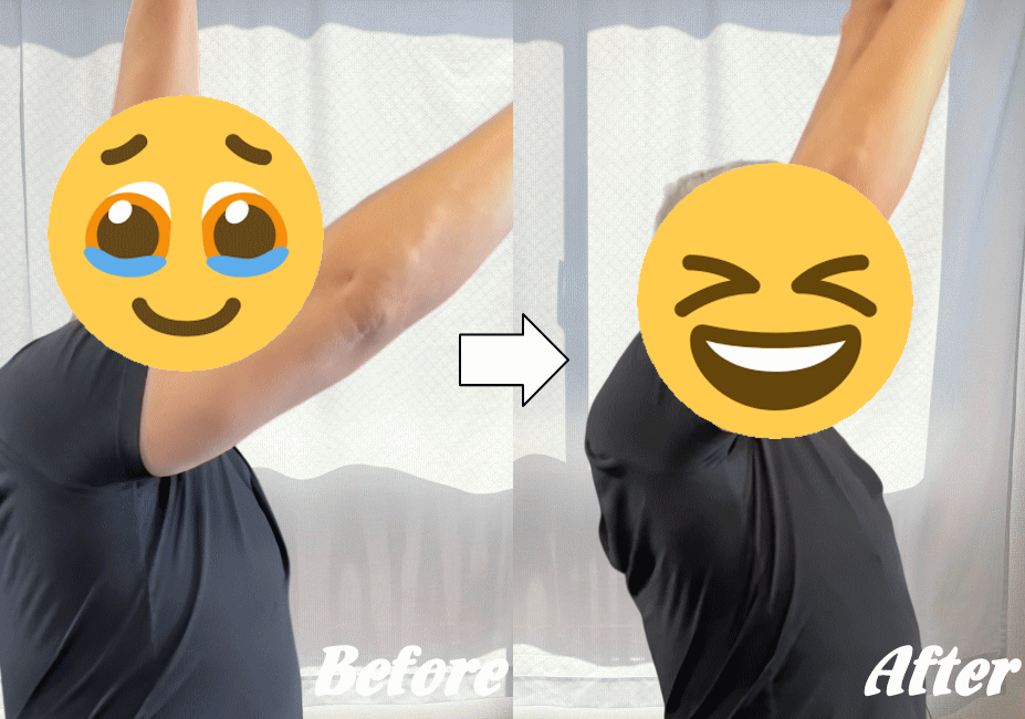 施術前と施術後24