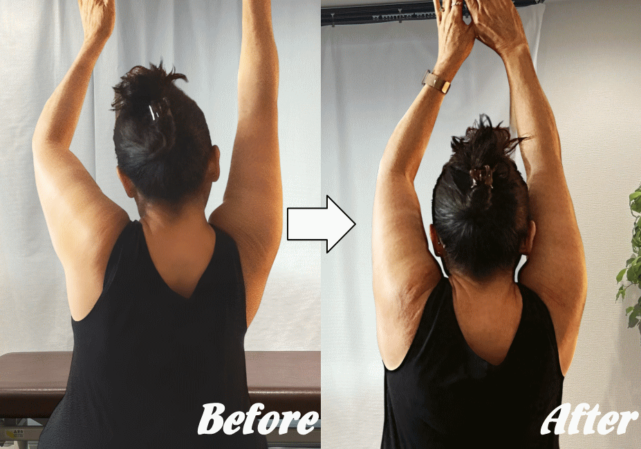 施術前と施術後25