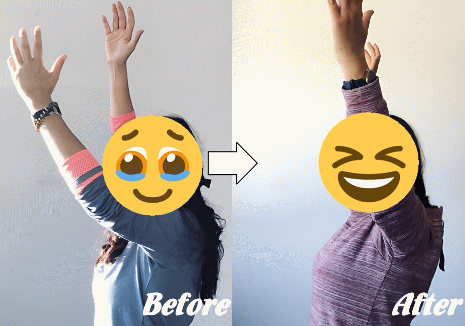 施術前と施術後26