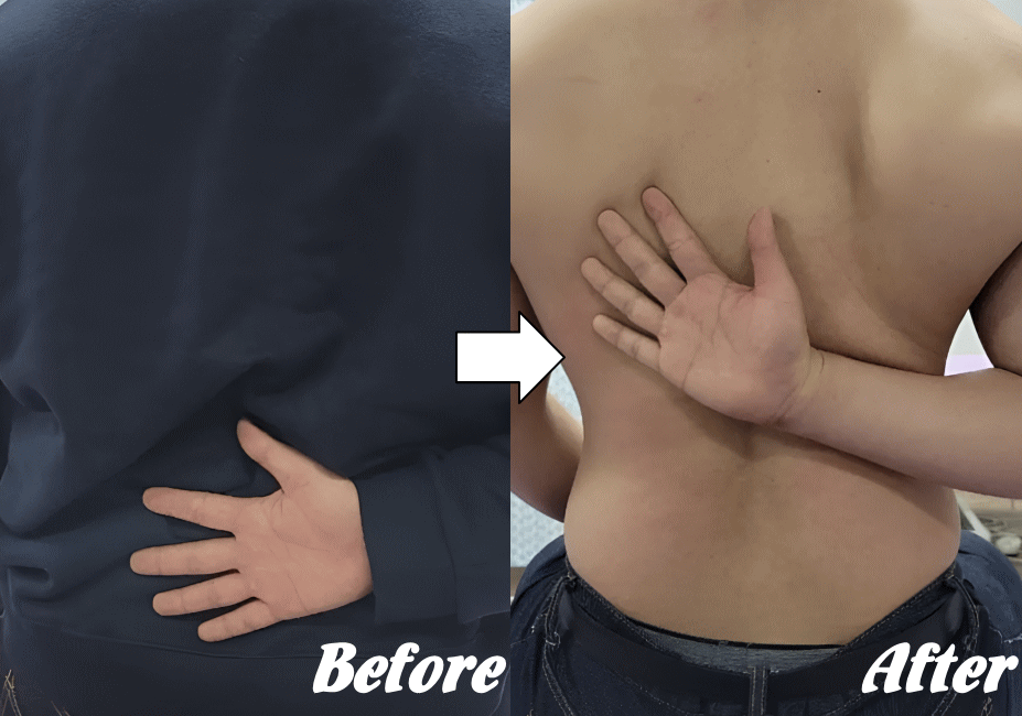 施術前と施術後27