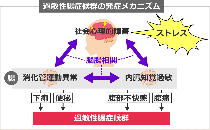 過敏性腸症候群の発症メカニズム
