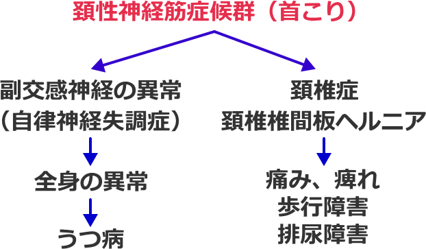 頚性神経筋症候群から発展