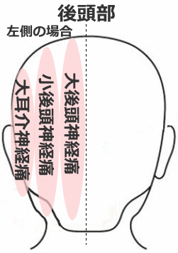 後頭神経痛の箇所