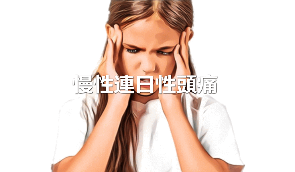 慢性連日性頭痛