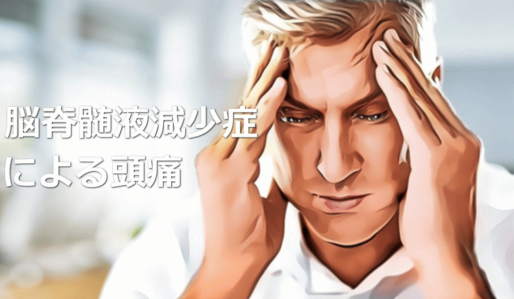 脳脊髄液減少症による頭痛