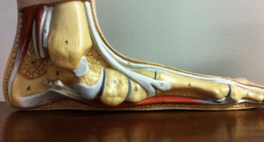 足のアーチがなくなった状態