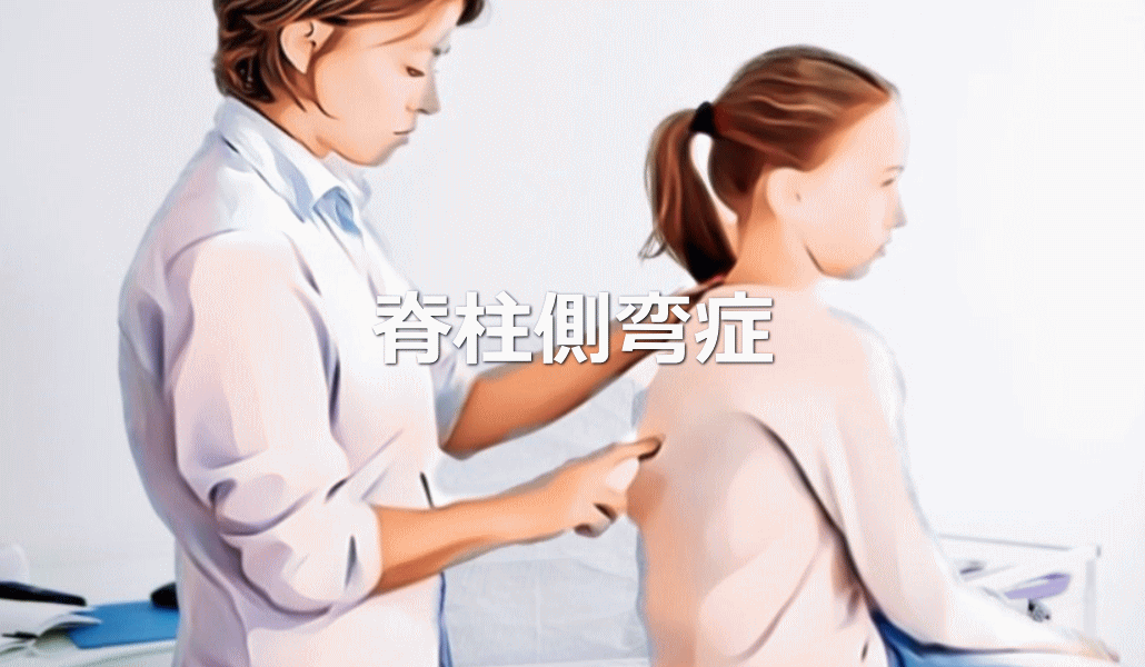 脊柱側弯症